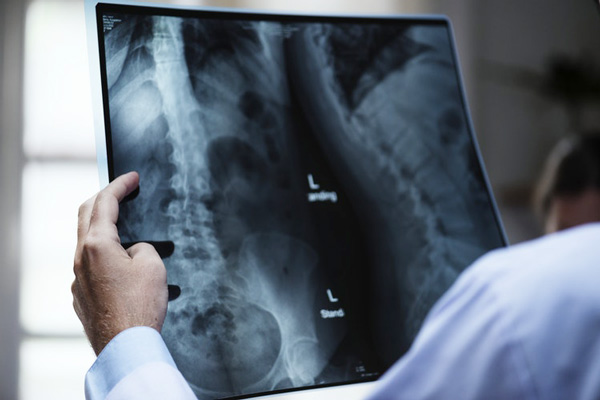 ความคุ้มครองจาก พรบ. ที่หลายๆ คนอาจลืม