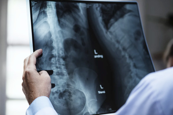 เอกสารใช้เบิก พ.ร.บ. รถยนต์ มีอะไรบ้าง?