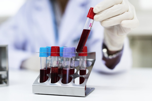 ตรวจสุขภาพประจำปี ใช้สิทธิประกันสังคมได้