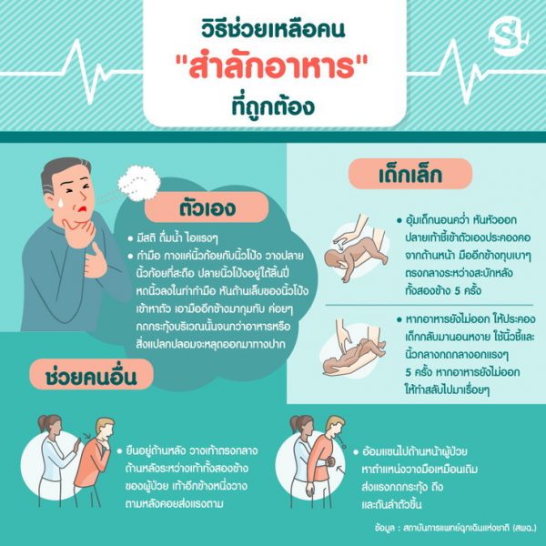 Masii ชวนรู้! วิธีช่วยเหลือ คนสำลักอาหาร อาหารติดคอ เด็ก-ผู้ใหญ่ ปฐมพยาบาลอย่างไร